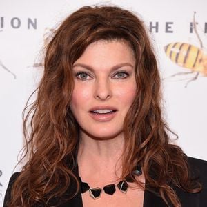 Verpfuschte OP: Topmodel Linda Evangelista schließt damit ab