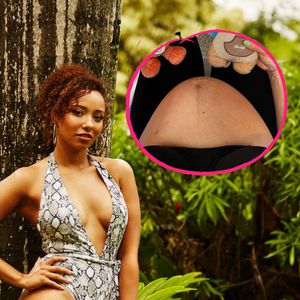Ex-Bachelor-Girl Linda Reschkes Babybauch ist schon riesig