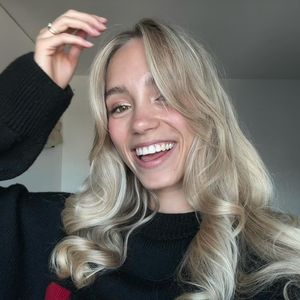 Trotz Haarausfall: Lisa Mantler feiert neue "Mama-Frisur"