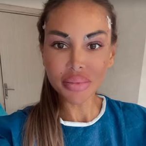 XXL-Lippen ade: Lisha Savage will zurück zur Natürlichkeit