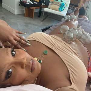 Ehrlicher Einblick: Lizzo zeigt sich bei Schröpfbehandlung