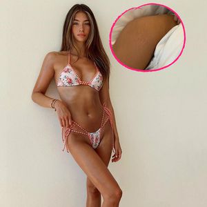 Model Lorena schämt sich nicht für ihre Dehnungsstreifen