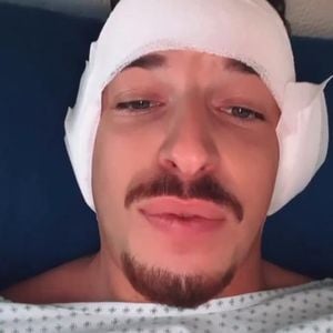 "Love Island"-Nico meldet sich nach seiner Ohren-Beauty-OP