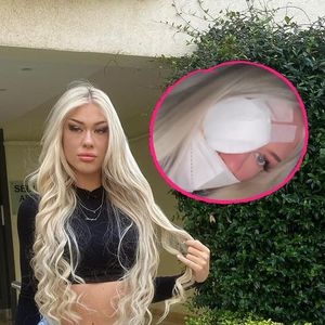 Lockenstab: "Temptation Island"-Luisa verbrennt sich im Auge