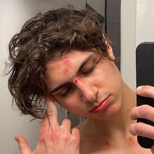 "Habe nicht nachgedacht": Lukas Rieger hat sich verletzt!