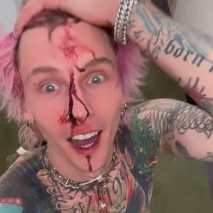Machine Gun Kelly schockt nach Konzert mit blutigem Gesicht