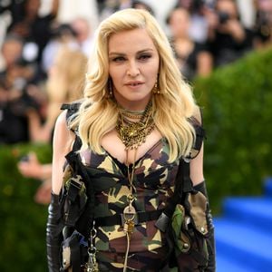 Nach Knieverletzung: Madonna bereit für ihr Bühnen-Comeback?