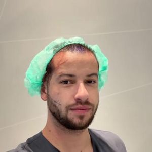 Haare und Bart: Marc-Robin Wenz besucht erneut Beauty-Doc