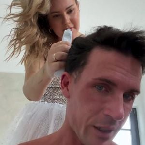 "Ist heftig": Tobias Wolf leidet an kreisrundem Haarausfall