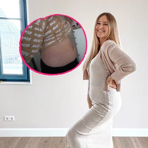Dehnungsstreifen und Nabelbruch: Maren gibt ehrliches Update