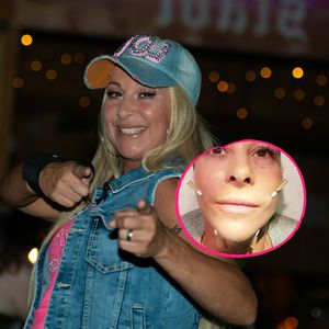 Autsch! Malle-Krümel zeigt sich mit Nadeln beim Face-Lifting