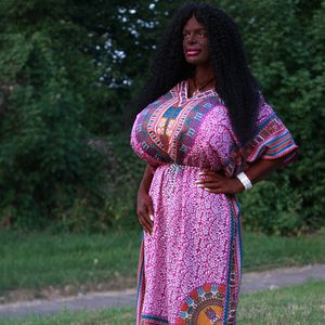 Trotz Extrem-OPs: Rippen-Entnahme für Martina Big No-Go!