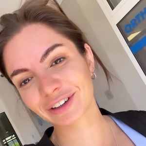Haartransplantation: Michèle de Roos' Augenbrauen-Make-over