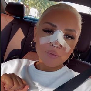 "Rieche nichts": Michelle Daniaux gibt Update nach Nasen-OP