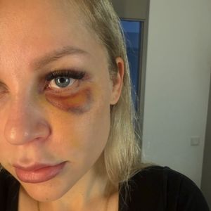 "Gewalt erlebt": Michelle Schellhaas teilt langes Statement