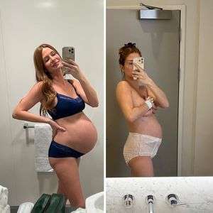 Millie Mackintosh teilt Vorher-Nachher-Fotos von der Geburt