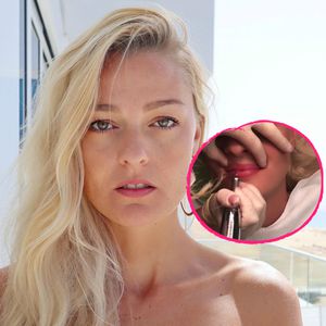 Ex-Stuntfrau Miriam Höller lässt sich Lippen pigmentieren