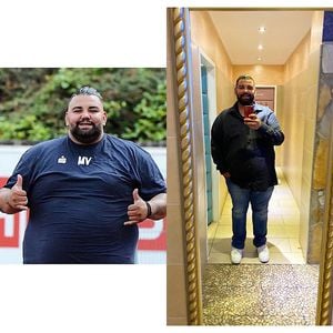 "Biggest Loser"-Mokka hat sich den Magen verkleinern lassen