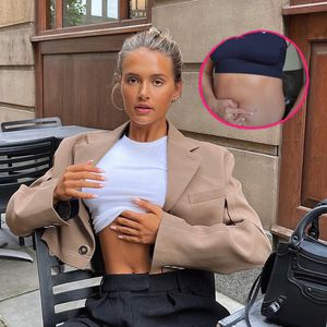 Nach Endometriose-OP: Molly-Mae Hague zeigt ihre Narbe!