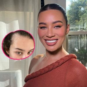 Montana Brown kämpft nach Geburt ihres Babys mit Haarausfall