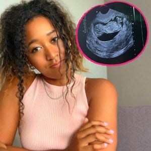 Tennis-Superstar Naomi Osaka ist zum ersten Mal schwanger!