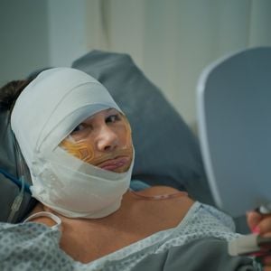 Halsstraffung: Natascha Ochsenknecht zeigt sich nach OP