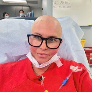 Nach Krebsdiagnose: Nicole Eggert rasiert sich eine Glatze