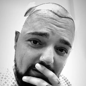 Zur Hochzeit nicht ready? Niks Haare müssen 12 Monate heilen