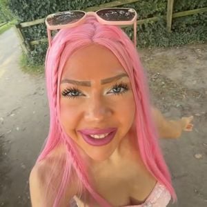 Drei Wochen auf dem Kopf: Nina Bridney setzt Perücke bald ab