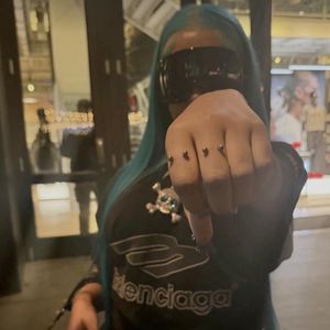 Blutergüsse: North West (12) entfernt ihre Hand-Piercings