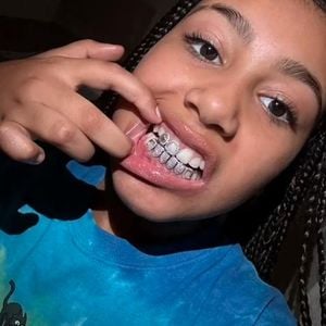 Nach Rap-Debüt: North West (10) zeigt ihre funkelnden Grillz