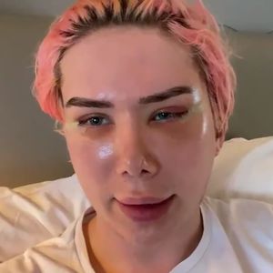 Oli London stellt klar: BTS nicht Hauptgrund für Beauty-OPs