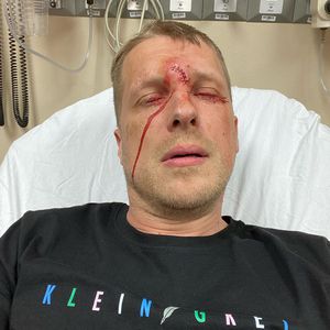 "Zum Leidwesen von mir": Oliver Pocher erklärt Jagdunfall!