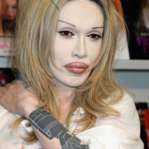 Zum Gruseln! Pete Burns von OPs übel zugerichtet!
