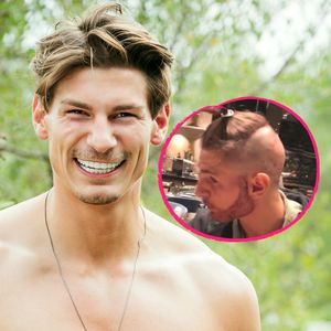 Beauty-OP: "Love Island"-Philipp macht Barttransplantation