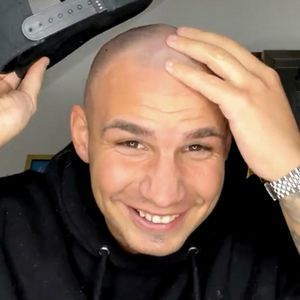 Live im Netz: Pietro Lombardi rasiert sich eine Glatze!