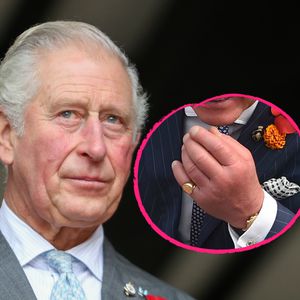 Total aufgedunsen: Was ist mit Prinz Charles' Händen los?