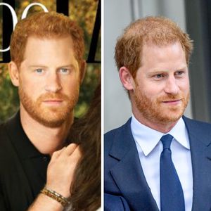 "Retusche": Harrys Haar auf Cover ganz anders als in echt