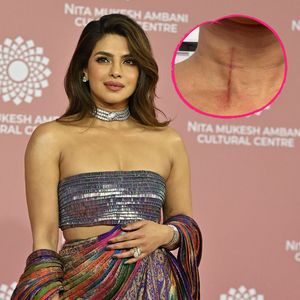 Hart im Nehmen: Priyanka Chopra zeigt ihre Stuntverletzung!
