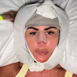 Rachel Uchitel zeigt sich nach zehnstündigem Facelift