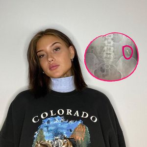 Wegen Piercing: "Are You The One?"-Jill Lange im Krankenhaus