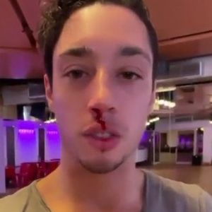 Zu wild? René Casselly blutet beim "Let's Dance"-Training!