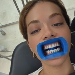 Rita Ora teilt Mundsperre-Selfie vom Besuch beim Zahnarzt
