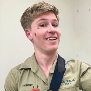 Autsch! Robert Irwin verletzt sich bei fiesem Fahrradunfall