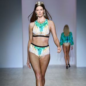 Blutiges Gesicht: Model Robyn Lawley stürzte Treppe hinunter