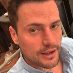 Pickel und Schwellung: Die Folgen von Rocco Starks XXL-Lauf