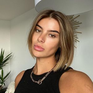 Beauty-Wahn: Darum ließ sich GNTM-Romina die Lippen machen