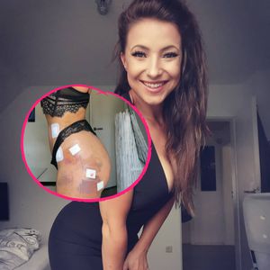 Vier Liter: "Ex on the Beach"-Roxy ließ sich Fett absaugen!