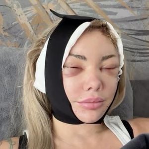 Realitystar Sabrina zeigt geschwollenes Gesicht nach Lifting