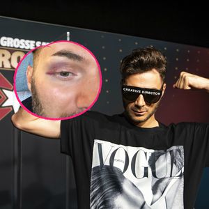 "Andenken von Serkan": Sam Dylan zeigt Promiboxen-Veilchen